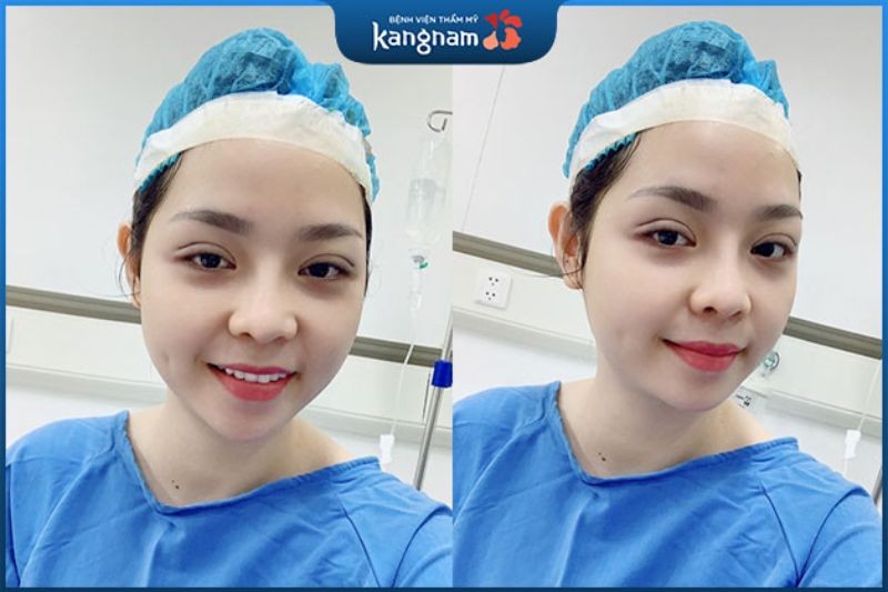 Nhấn Mí: Chi Phí, Địa Chỉ Uy Tín và Những Điều Cần Biết Để Có Đôi Mắt Đẹp Tự Nhiên 11 Khách hàng trải nghiệm dịch vụ nhấn mí tại Bệnh viện Thẩm mỹ Kangnam